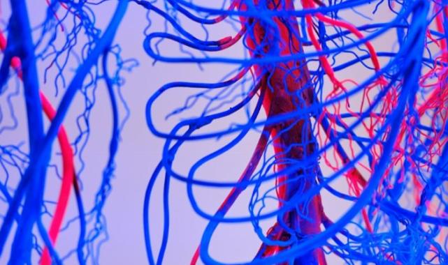 Damar tıkanıklığı tedavisinde yeni nesil yöntemler!