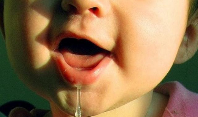 Çocuklarda salyanın nedeni geniz eti büyümesi!