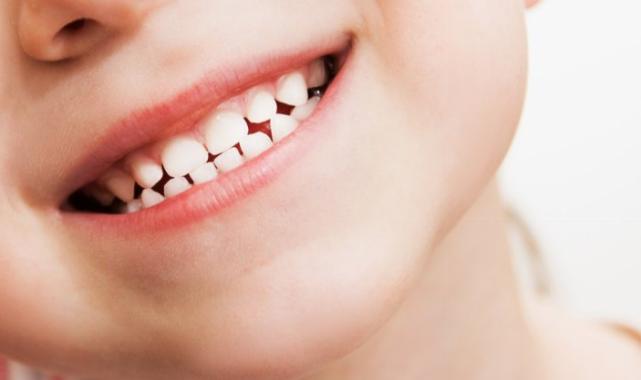 Ağzında yemek tutan çocuklarda dişler daha kolay çürüyor