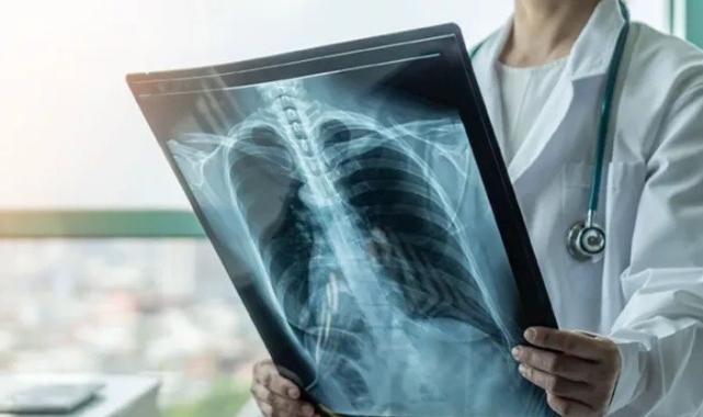 2023 yılında en çok ölüm, hangi hastalıktan kaynaklandı?