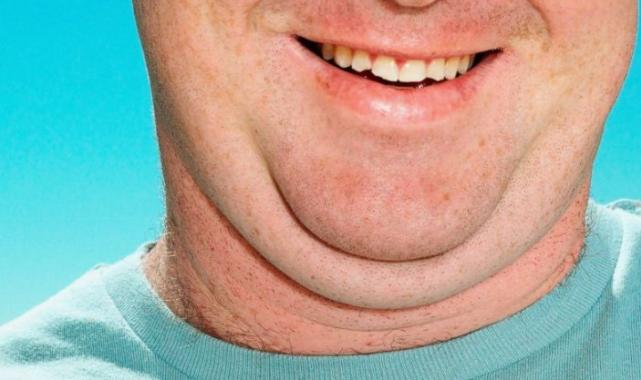 Erkeklerde yeni moda gıdı estetiği