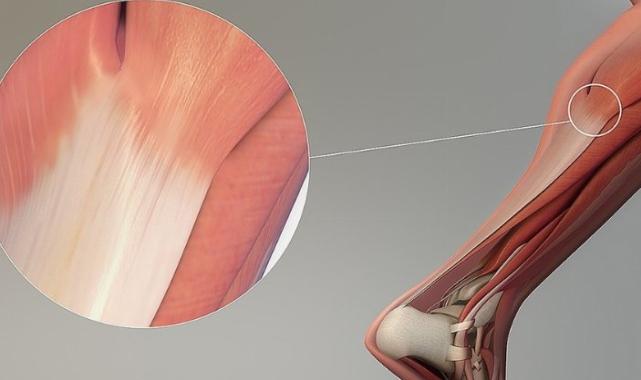 Yaz sıcağında bu spor sakatlanmasına dikkat!