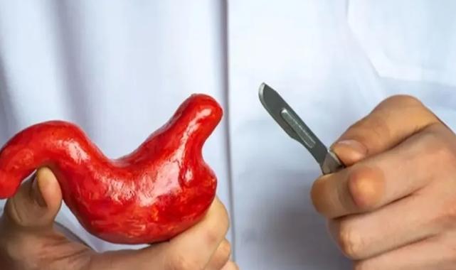 Mide küçültme ameliyatlarındaki ölüm vakaları artıyor