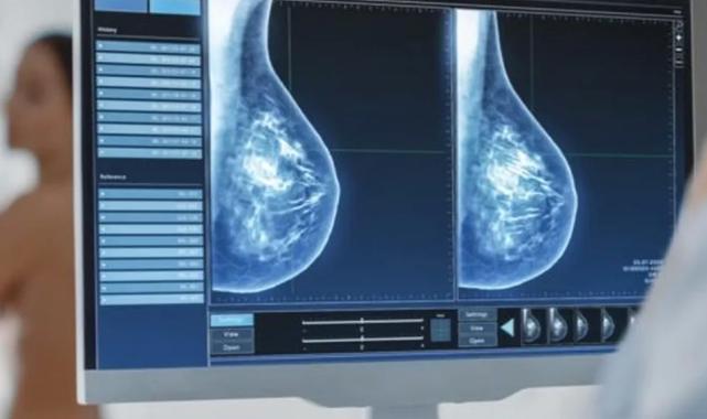 Kötü haber korkusu mamografi taramasına engel!