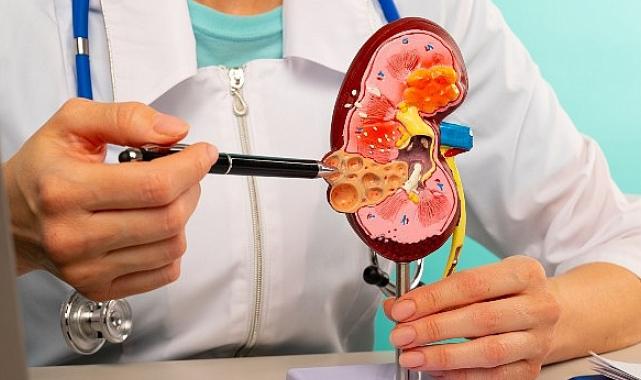 Otozomal dominant polikistik böbrek hastalığı ömür boyu sürüyor