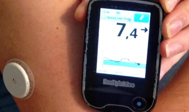 Sensörler diyabetli çocukların okul ve sosyal hayatını normalleştiriyor