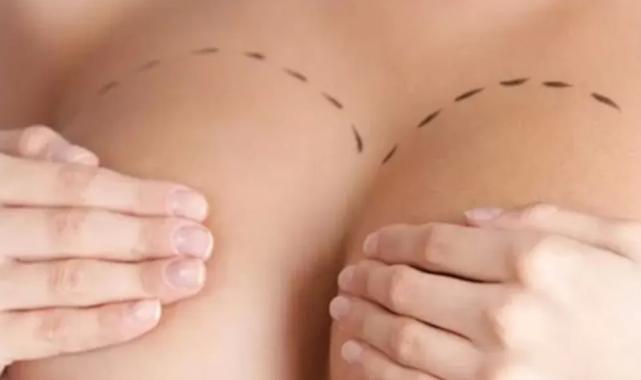 Büyük göğüsler, büyük sorunlar… Ameliyata kimler uygun aday?