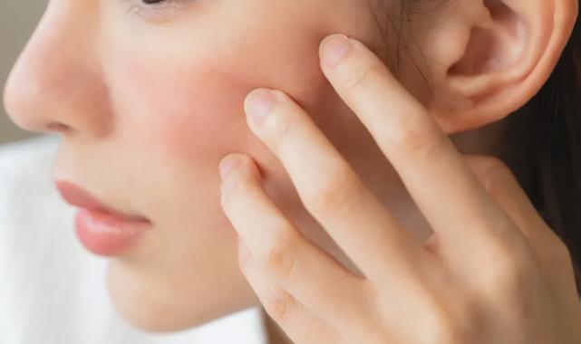 Cilt kuruluğu deyip geçmeyin!