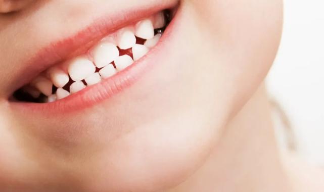 Çocuklarda diş çürüklerinin nedenleri… Alınması gereken önlemler