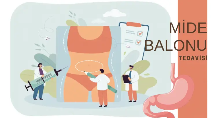 Mide Balonu Nedir?
