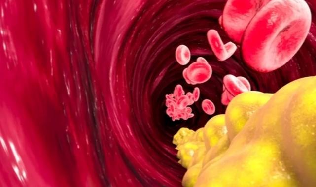 Kan yağları neden yükselir? Nelere dikkat etmeliyiz?