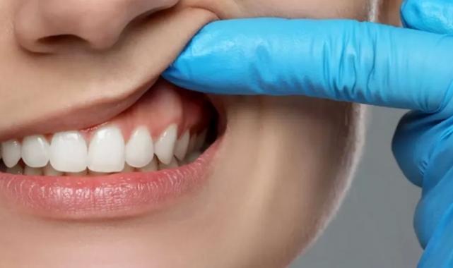 Diş eti çekiliyorsa kemik de eriyordur!