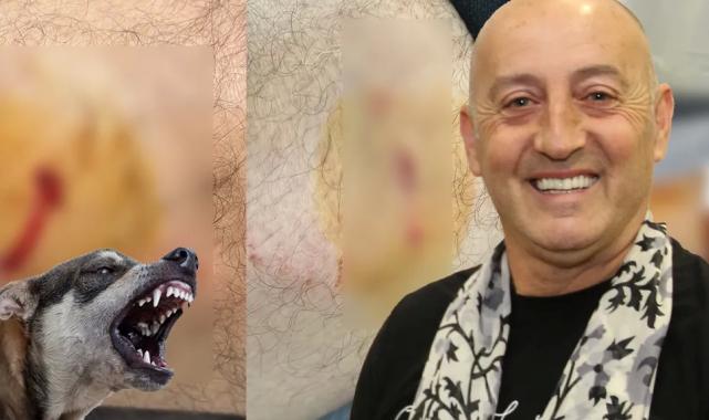 Gemlik Karacaali Muhtarı’na sokak köpeklerinden saldırı!