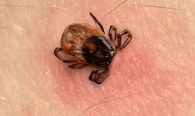 ERÜ’den KKKA uyarısı