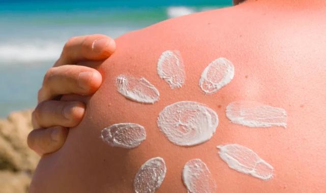 Güneş yanığına dikkat!