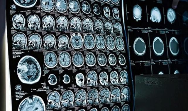 Ücretsiz kanser taramaları için SMS ile bilgilendirme dönemi