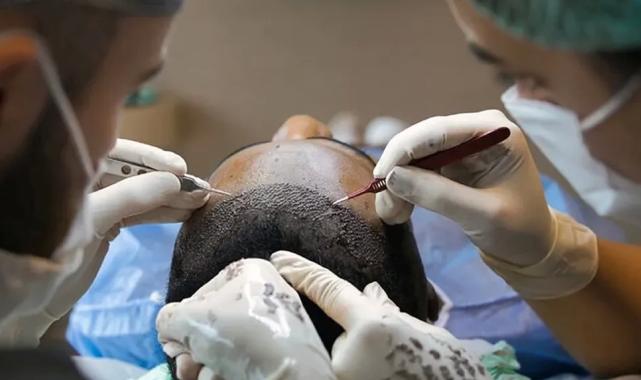 Sağlık Bakanlığı’ndan saç ekimi birimlerinde yeni dönem