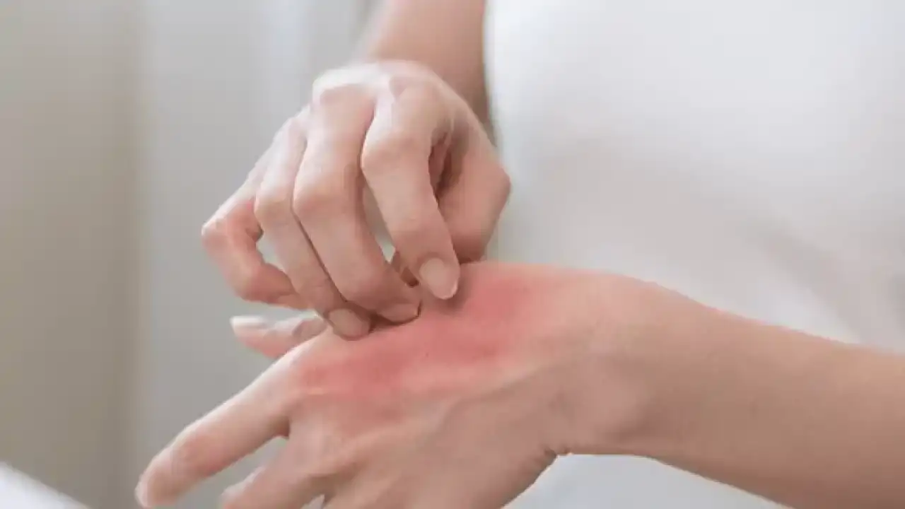 Stres ve kaygı egzamayı tetikleyerek kısır döngü yaratıyor